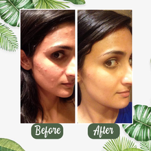 Load image into Gallery viewer, Final Sale - Green Tea Deep Cleanse Mask - Free Shipping [Last Day!]
